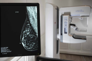 Octubre Rosa: hasta el 27 se realizan Mamografías Digital en Hospital de Carhué
