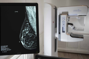Mes de prevención del cáncer de mama: realizan mamografías sin turno en hospitales públicos bonaerenses