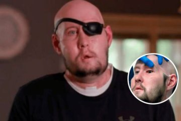 Logran hacer el primer trasplante de ojo completo en el mundo