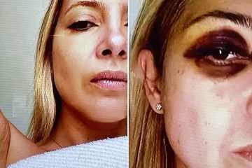 Aparecen fotos y chats de la denuncia de Fabiola Yañez contra Alberto: “Venís golpeándome hace tres días seguidos”