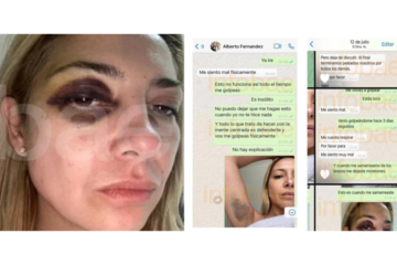 “Vergüenza”: la indignación del arco político por las fotos de la denuncia de Fabiola Yañez