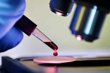 Alerta en Australia por la desaparición de cientos de frascos con virus mortales de un laboratorio