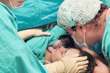 Un hito más del Garrahan: Nació la primera bebé operada dentro del útero materno