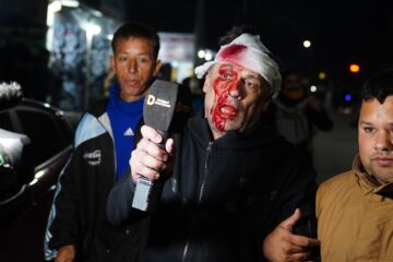 Libertarios golpearon y le partieron la cara a un periodista de América TV en el acto de Milei