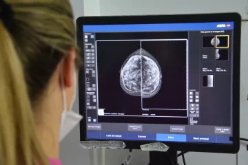 Prevención del cáncer de mama: el gobierno bonaerense comenzará a indicar la mamografía a los 40 años