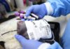 No más donación por reposición: el Gobierno cambió el sistema para donar sangre e introdujo nuevos criterios