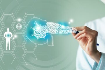 Esperanza contra el cáncer de páncreas: un nuevo tratamiento logró duplicar la supervivencia de pacientes con metástasis Esperanza contra el cáncer de páncreas: un nuevo tratamiento logró duplicar la supervivencia de pacientes con metástasis