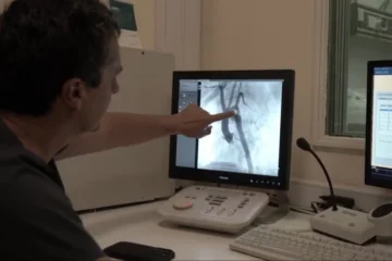 Hito médico en Argentina: salvan a un bebé de 49 días implantandole un stent que se disuelve en un año Hito médico en Argentina: salvan a un bebé de 49 días implantandole un stent que se disuelve en un año